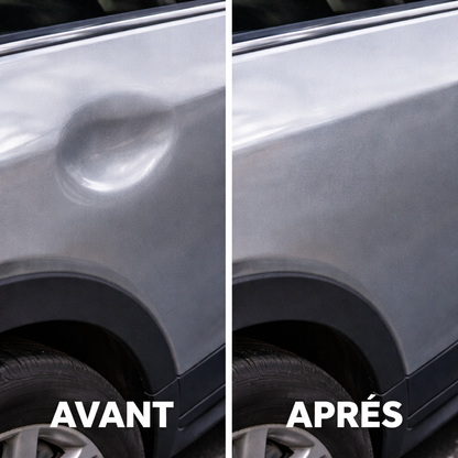 Kit de Débosselage Sans Peinture – Réparation Bosses Voiture DIY